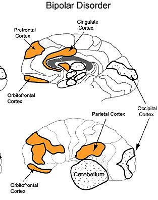 Tag theories for how bipolar disorder works in the brain | Thrive With Bipolar Disorder