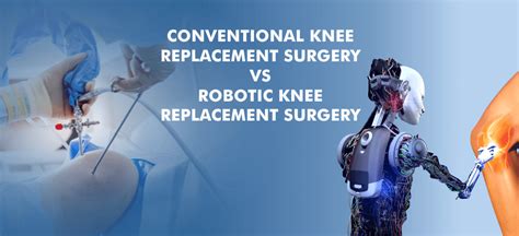 Conventional VS Robotic Knee Replacement Surgery - Amandeep Hospital