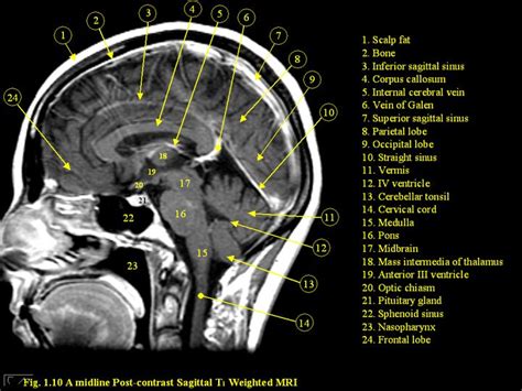 54 best MRI anatomy images on Pinterest | Radiology, Anatomy and Safari