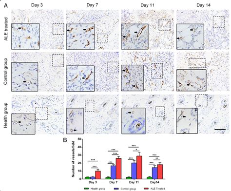 Angiogenesis in vivo. a Immunostaining of CD31+ vessels (black arrows)... | Download Scientific ...