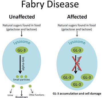 Fabry Disease – newbornscreening.info