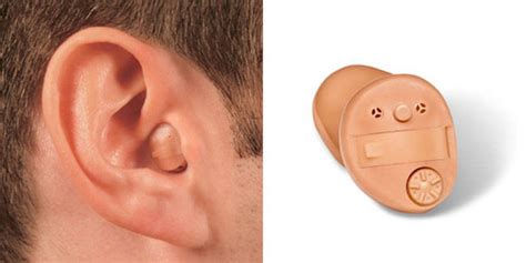 ITC (In The Canal) Hearing Aids - Features, Benefits & Price