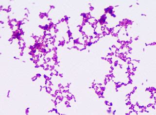 Mycobacterium Bacteria Images & Photographs from Science Prof Online