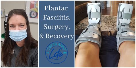 Plantar Fasciitis, Surgery, and Recovery • The Circulating Life