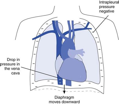 Extrapulmonary Effects of Mechanical Ventilation | Thoracic Key