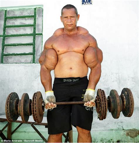 Wow Viral!: Muscle Addict Injects Synthol Into His Muscles Just To Get ...