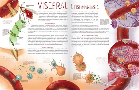 Visceral Leishmaniasis – Inessa Stanishevskaya | Biomedical Communication