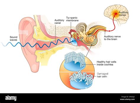 Inner ear hair cells hi-res stock photography and images - Alamy