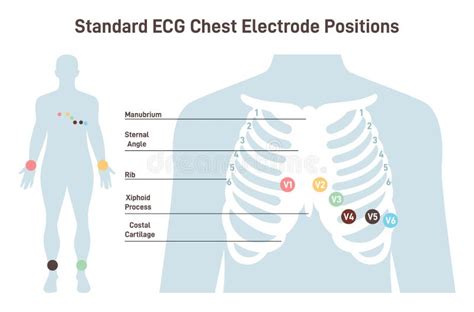 Position of ECG Chest Leads. Cardiovascular Checkup with Cardiogram ...