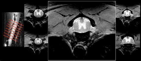 Mouse MRI CryoProbe | Bruker