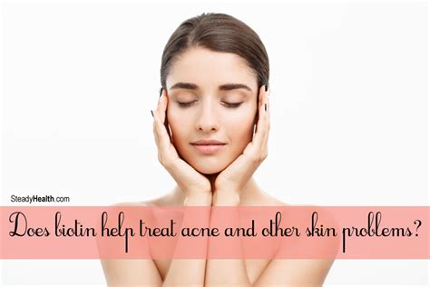 Biotin Benefits for Your Skin: Does Biotin Help treat Acne and Other ...