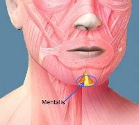 Chin Dimple Removal at non-surgical treatment clinics - Anti wrinkle treatment (Botox)