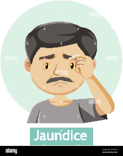 Cartoon character with jaundice symptoms Stock Vector Image & Art - Alamy