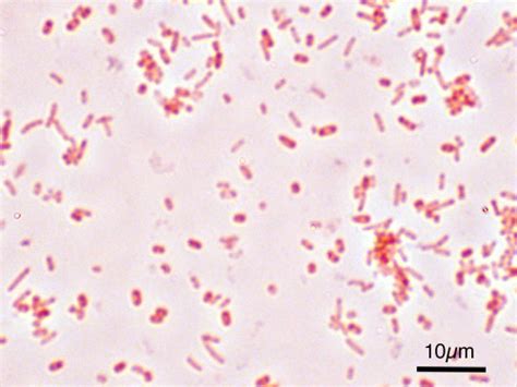 File:Salmonella Typhimurium Gram.jpg - Wikimedia Commons
