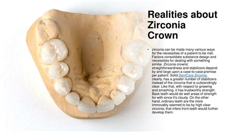 PPT - Introducing The Simple Way To Zirconia Crown PowerPoint ...