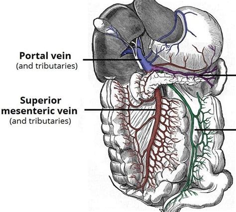 Pseudo-Obstruction - TeachMeSurgery