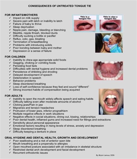 Tongue-Tie and Lip-Tie in Infants | Dentist in Arlington, VA