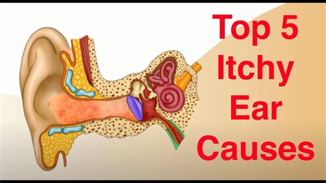 Top 5 Causes of Itchy Ears (and Treatment Too!) - YouTube