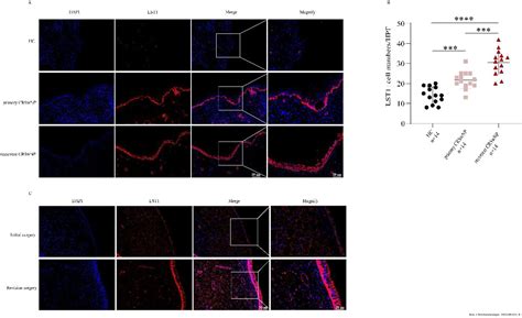 Significance of leukocyte-specific transcript 1 levels in nasal mucosal tissue to predict ...