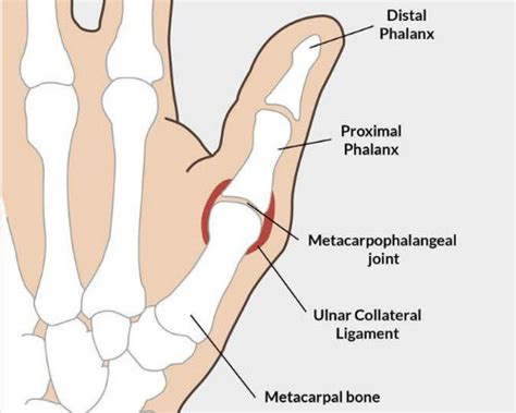 Radial Collateral Ligament Thumb Mri