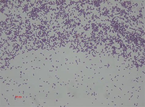 Enterococcus Faecalis Gram Stain