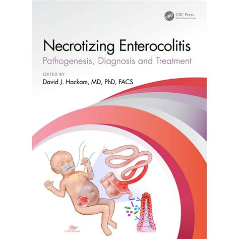 Necrotizing Enterocolitis : Pathogenesis, Diagnosis and Treatment ...