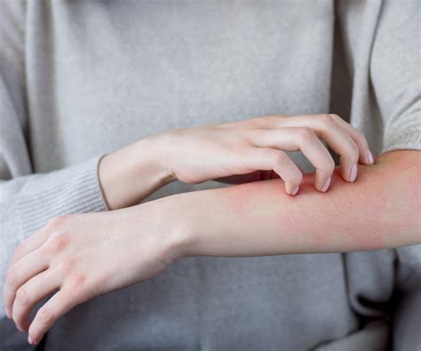 Maculopapular Rash: Causes, Treatment, and More