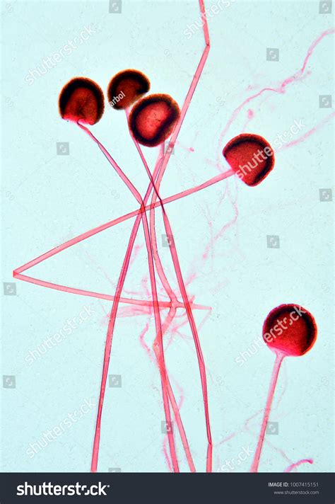 Rhizopus Sporangia Under Microscope Stock Photo 1007415151 | Shutterstock