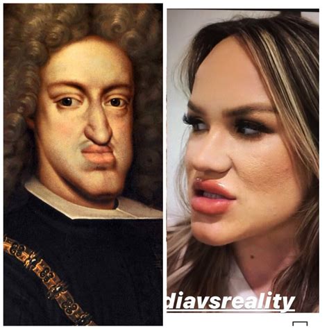 Lip injections have instagram celebrities looking like Chatles || of spain : r/HistoryMemes