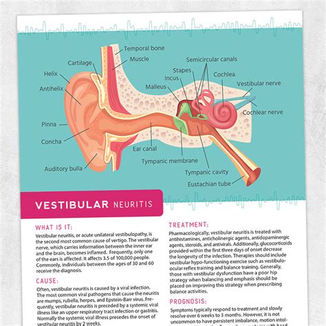 Vestibular Neuritis – Adult and pediatric printable resources for speech and occupational therapists