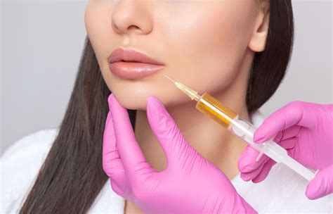 Dermal Filler Lip Injections - National Laser Institute Medical Spa