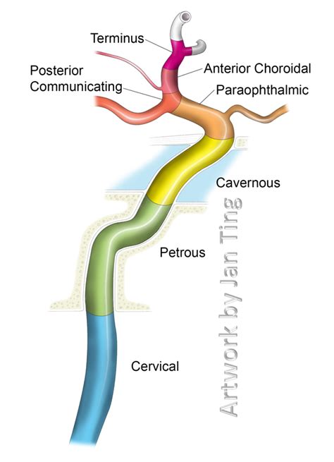 branches of ica by atlas anatomy - Google Search | Bloedvaten, Medisch