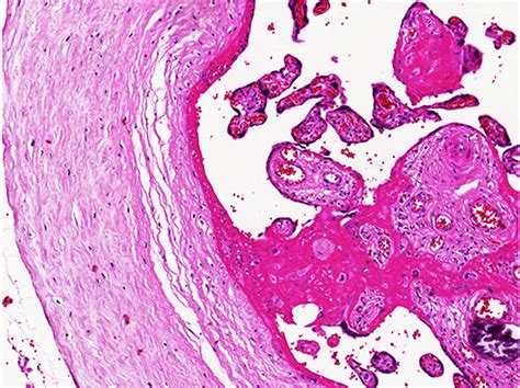 File:Placenta histology 008.jpg - Embryology