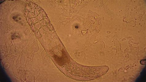 Demodex folliculorum mite under a microscope walking - YouTube