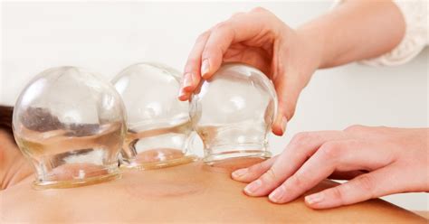 Why You Should Learn Cupping Therapy