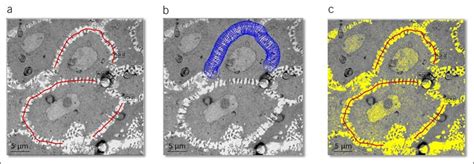 Illustrative image of the assessment of the intercellular space area... | Download Scientific ...