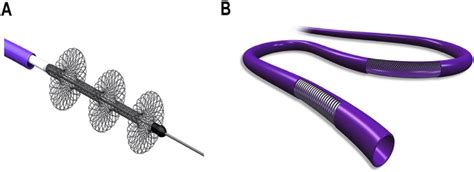 The Inari FlowTriever Catheter and Aspiration Guide Catheter. (A) Inari ...