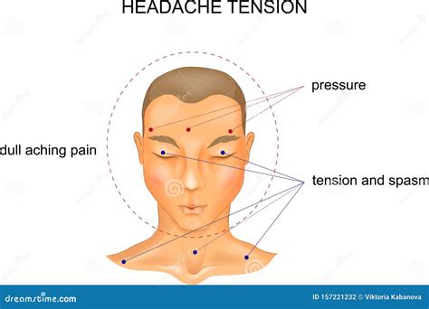 Tension headache symptoms stock vector. Illustration of brain - 157221232