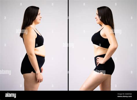 Woman Before And After Weight Loss On Gray Background. Body Shape Was ...