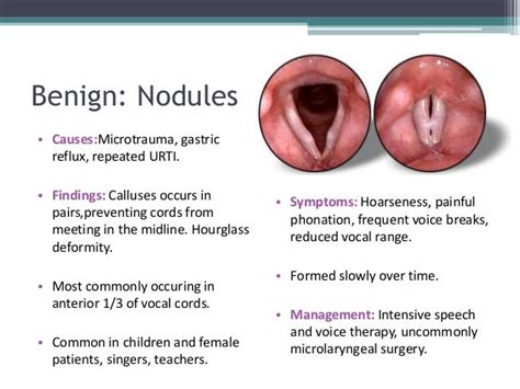 Larynx