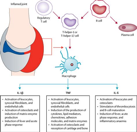 Current and future perspectives in the management of juvenile ...