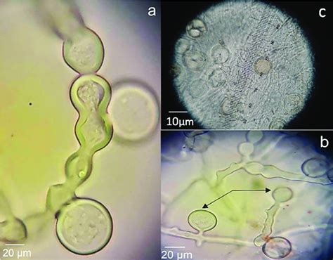 Phytophthora cinnamomi oomycete isolated from root rot of Cinnamomun... | Download Scientific ...