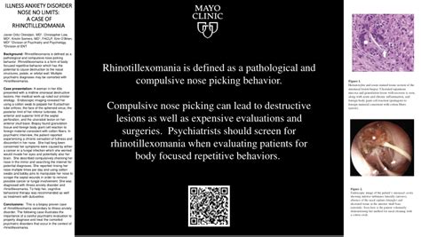 (PDF) ILLNESS ANXIETY DISORDER NOSE NO LIMITS: A CASE OF RHINOTILLEXOMANIA