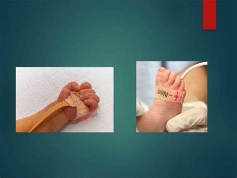 Pulse oximetry screening in newborns