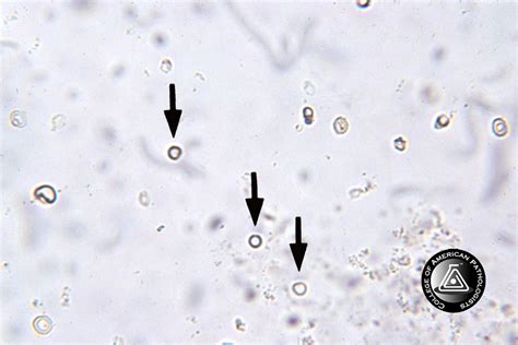 MCFP Urinalysis Competency Quiz - ProProfs Quiz