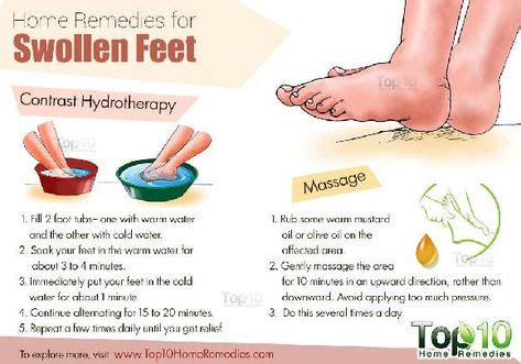 how to treat diabetes swollen feet in 2020 | Water retention remedies, Foot remedies, Swelling ...