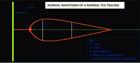 Normal schematic representation of a Thromboelastogram. | Download ...