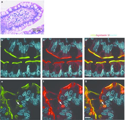 (a) Duodenal biopsy from normal control stained by Hematoxylin and... | Download Scientific Diagram