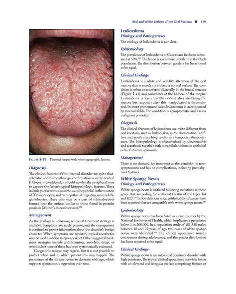 Leukoedema Histology