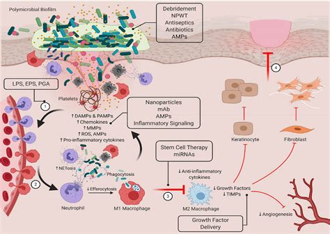 Frontiers | Biofilm-Innate Immune Interface: Contribution to Chronic Wound Formation